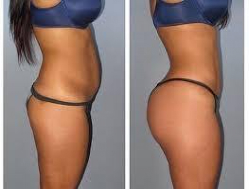 {{{[HOW TO  ENLARGE HIPS AND BUMS + Botcho, BREAST  Skin Lightening Pills and penis enlargment   QUICK RESULTS +27785167256}}}, Nairobi -  Kenya