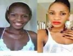 Skin Lightening/ Whitening [Bleaching]Products in South Africa +27678276964